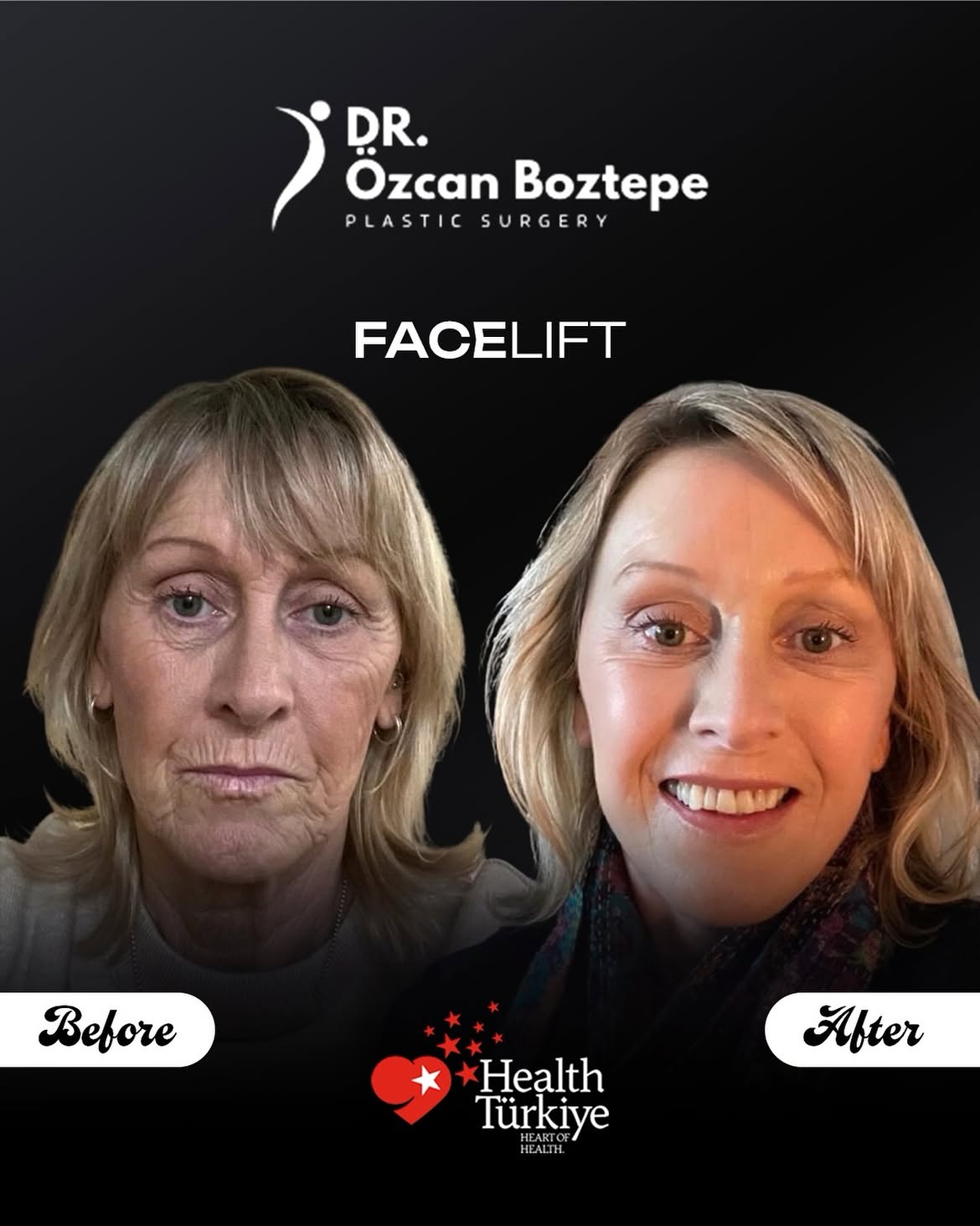 Op. Dr. Özcan Boztepe — Klinik Vaka 15