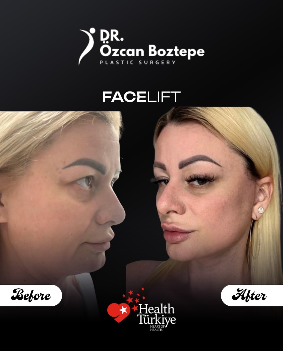 Op. Dr. Özcan Boztepe — Klinik Vaka 9