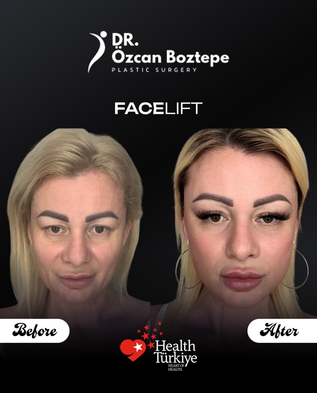 Op. Dr. Özcan Boztepe — Klinik Vaka 8