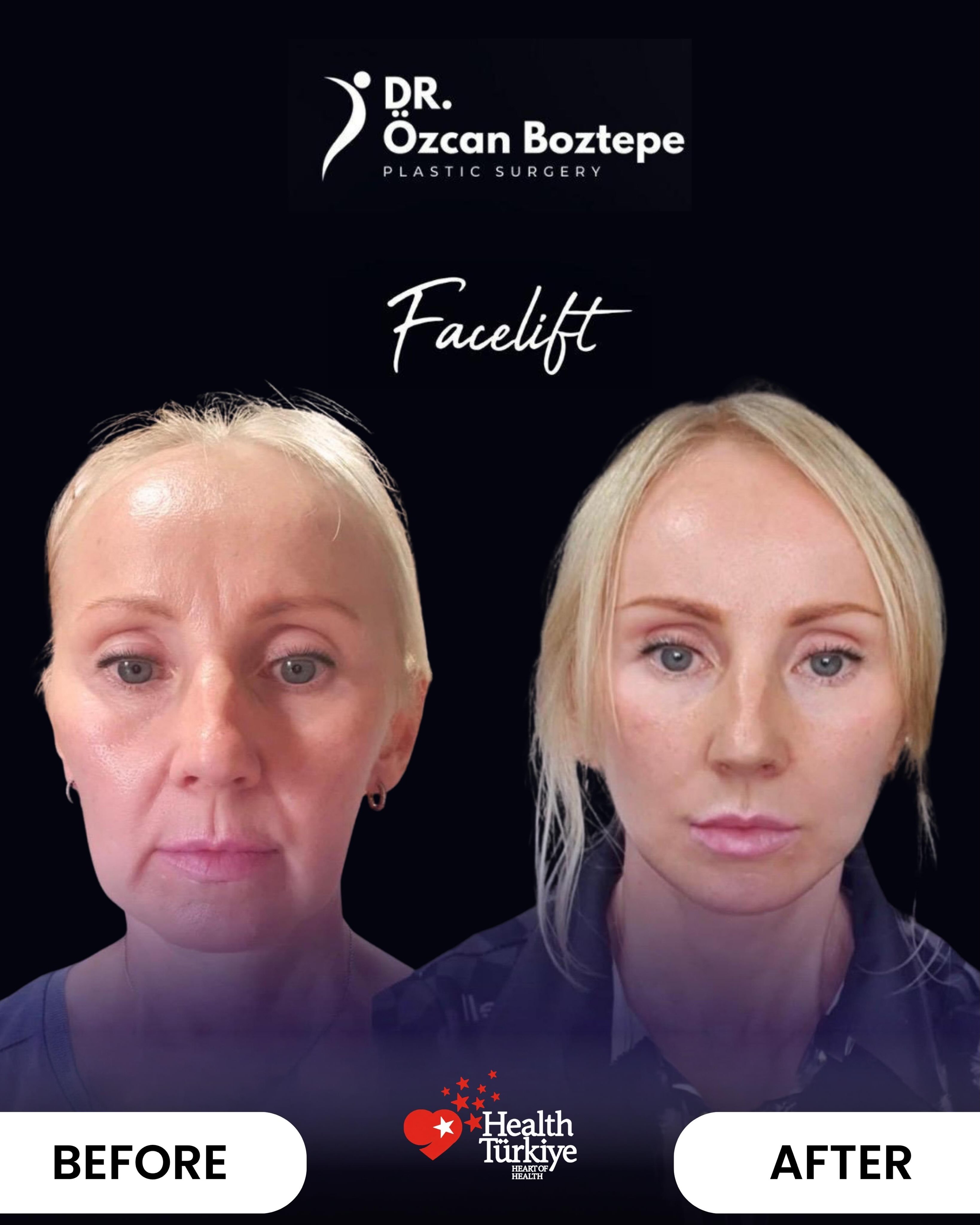 Op. Dr. Özcan Boztepe — Klinik Vaka 29