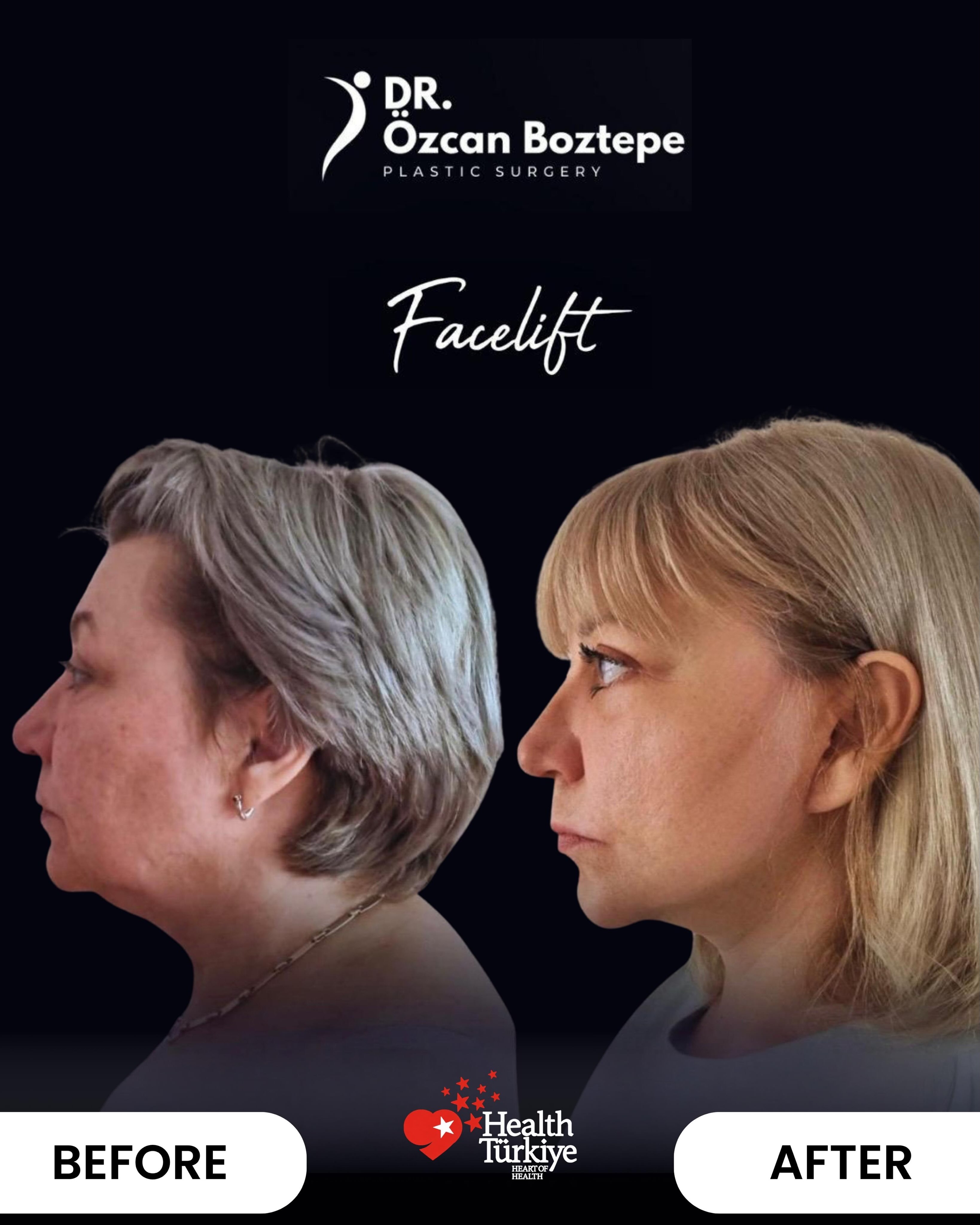 Op. Dr. Özcan Boztepe — Klinik Vaka 32