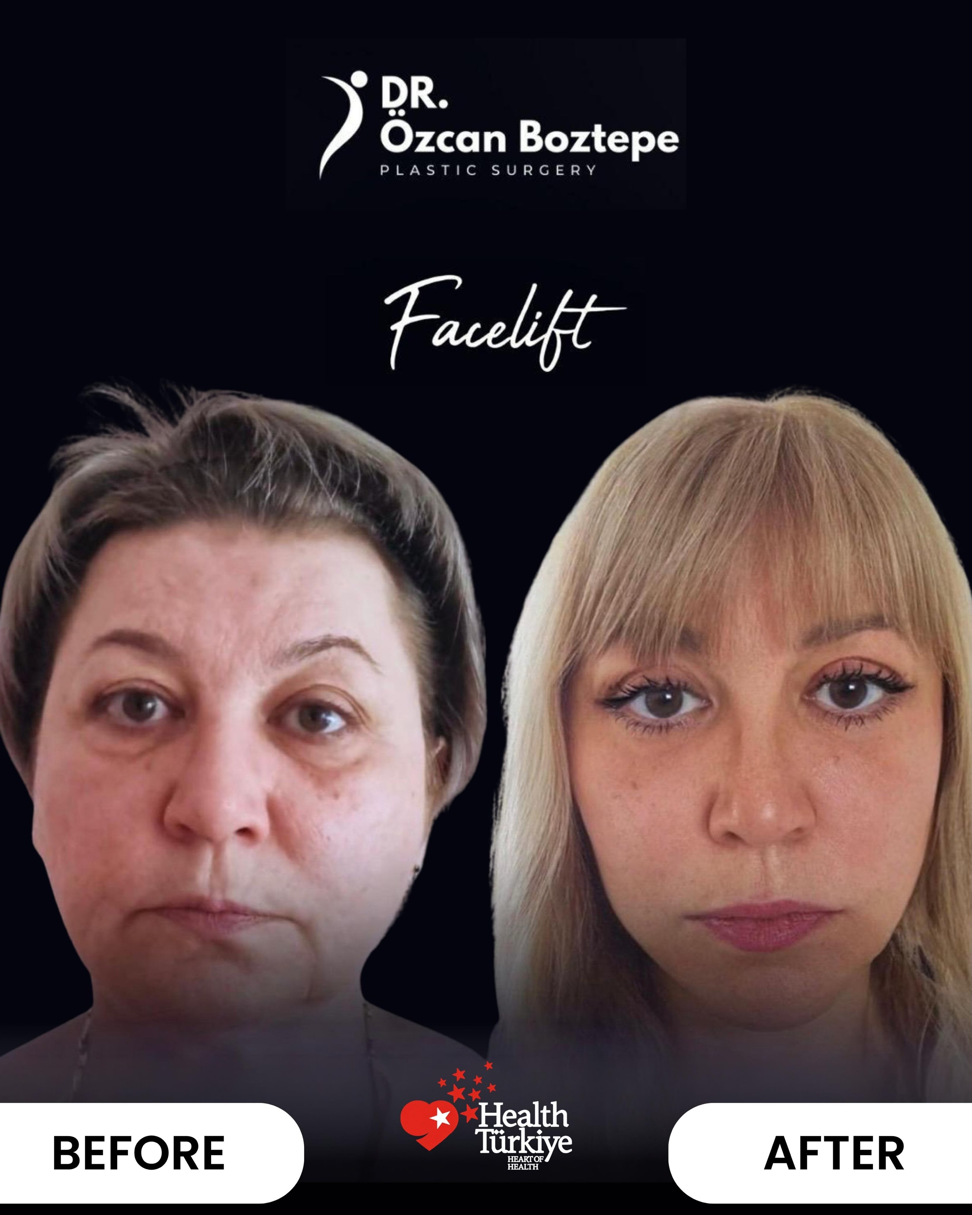 Op. Dr. Özcan Boztepe — Klinik Vaka 35
