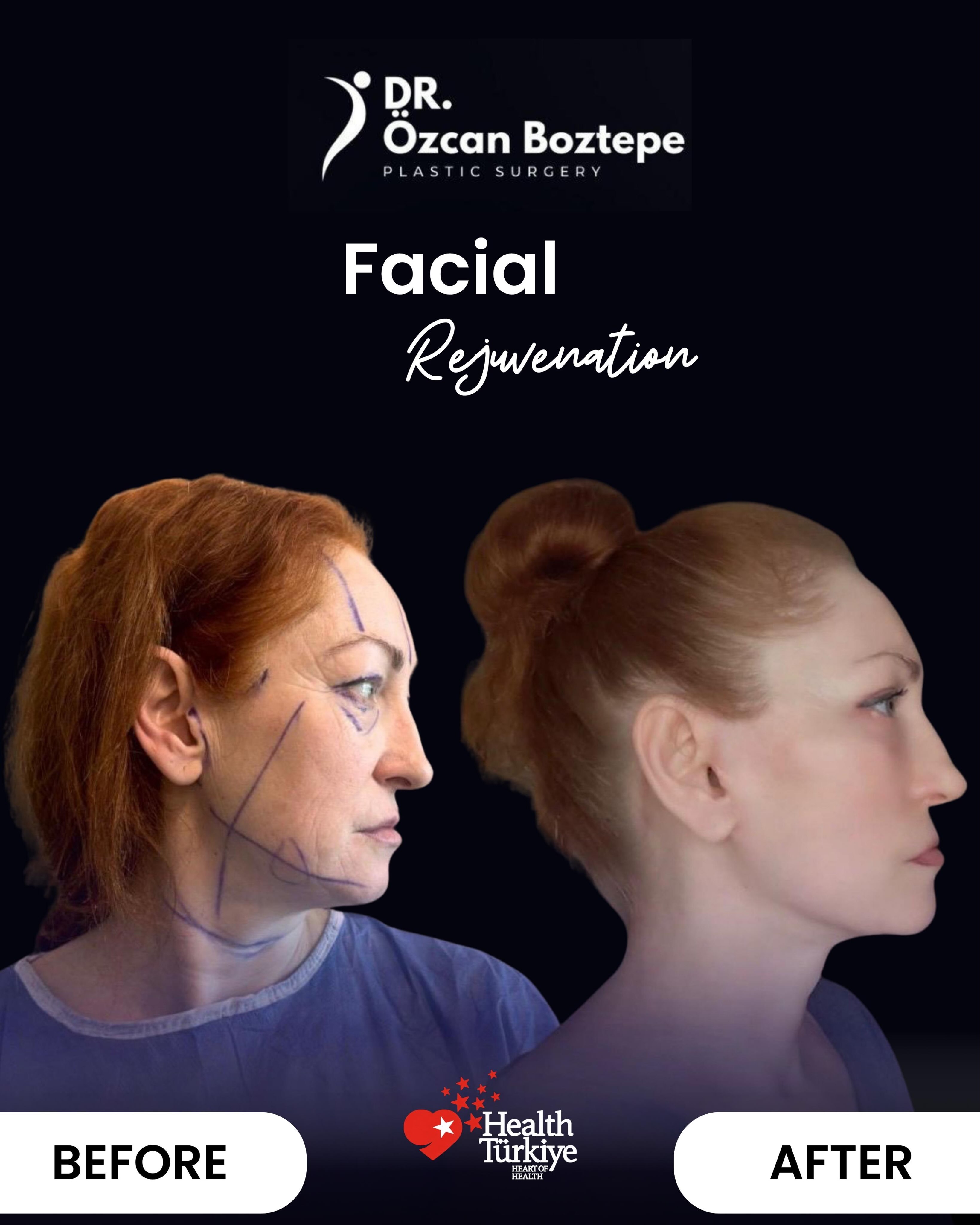 Op. Dr. Özcan Boztepe — Klinik Vaka 36