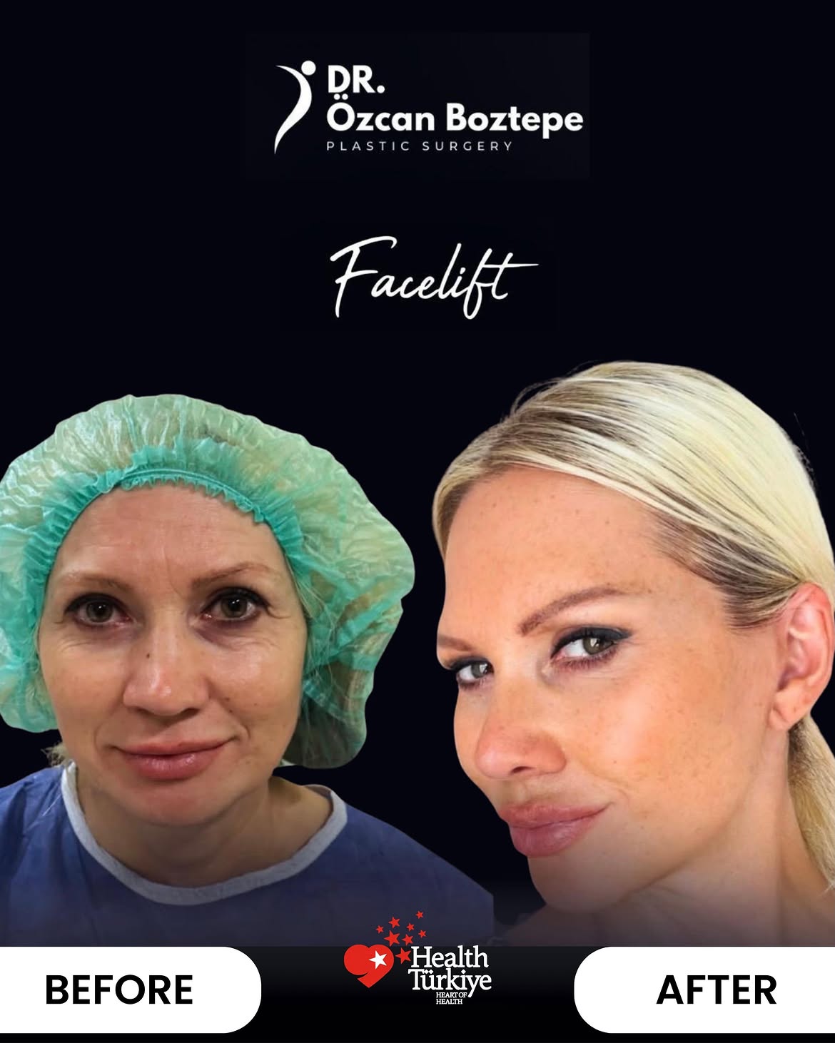 Op. Dr. Özcan Boztepe — Klinik Vaka 42