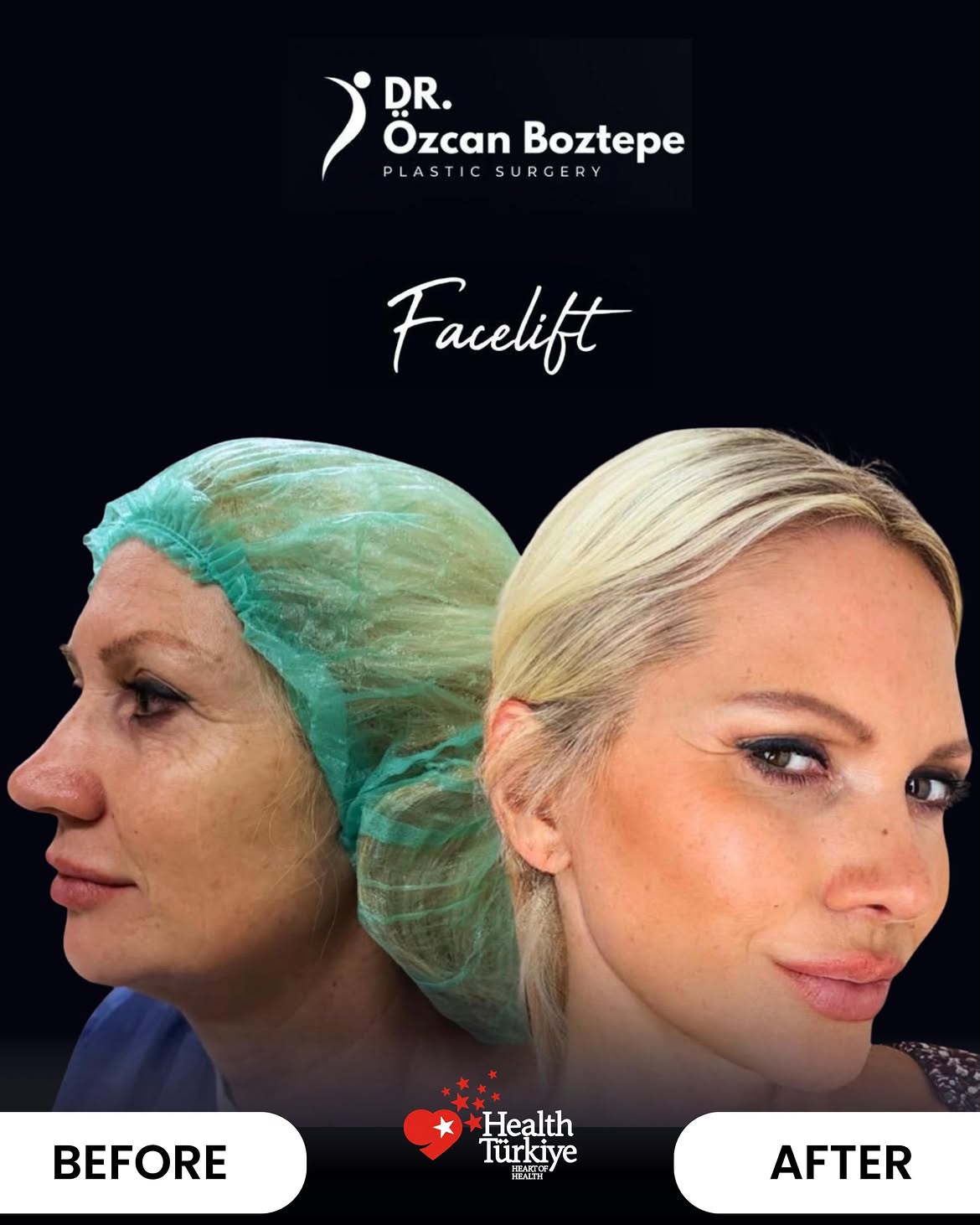 Op. Dr. Özcan Boztepe — Klinik Vaka 43