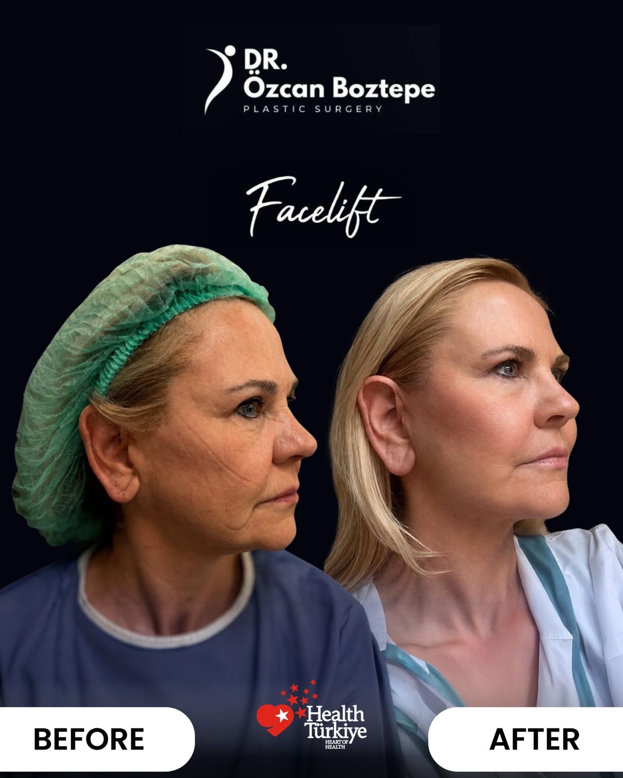 Op. Dr. Özcan Boztepe — Klinik Vaka 1