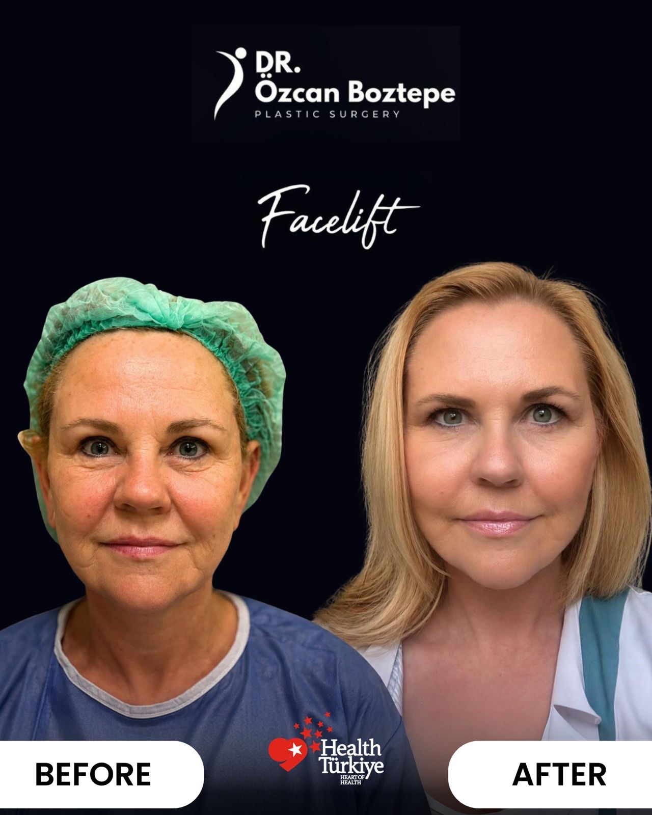 Op. Dr. Özcan Boztepe — Klinik Vaka 2