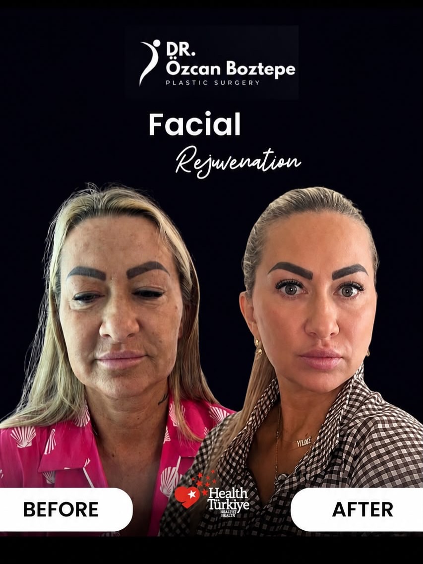 Op. Dr. Özcan Boztepe — Klinik Vaka 3