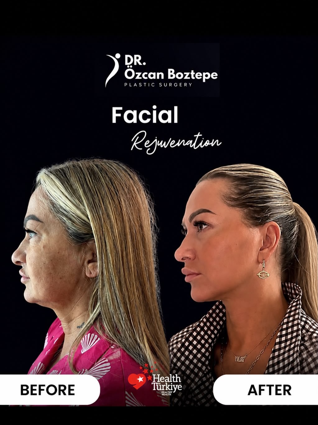 Op. Dr. Özcan Boztepe — Klinik Vaka 4